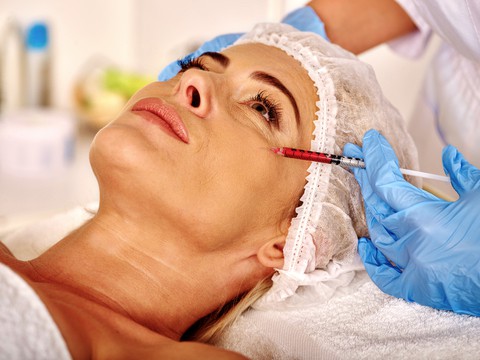 dermal fillers facelift