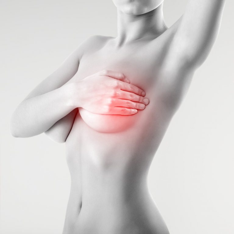 breast pain - breast implant removal